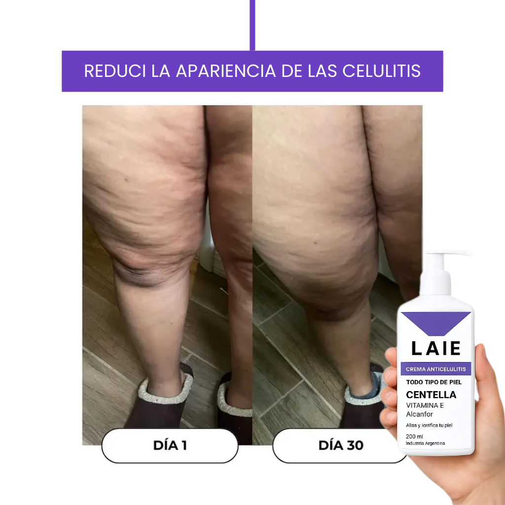 Crema Anticelulitis - 200ml Laie