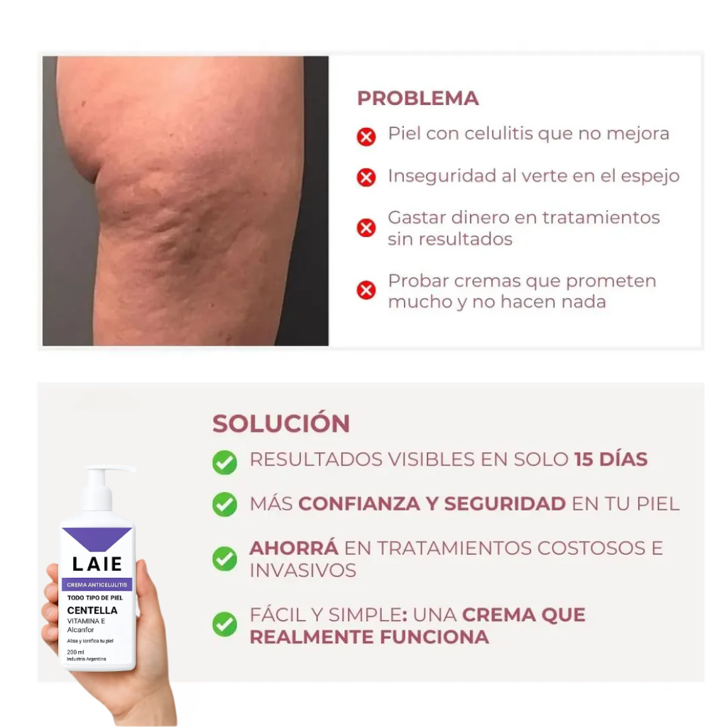 Crema Anticelulitis - 200ml Laie