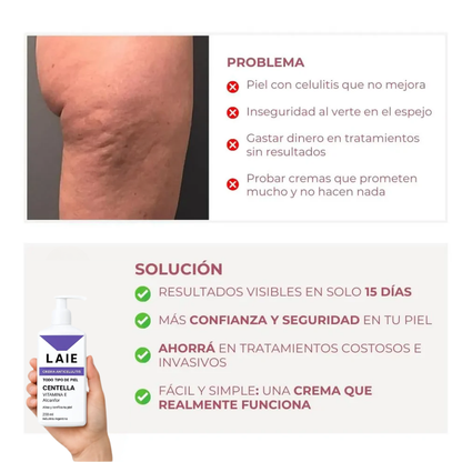 Crema Anticelulitis - 200ml Laie